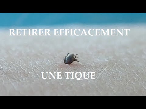 Le moyen le plus efficace pour retirer une tique Homme chien chats.