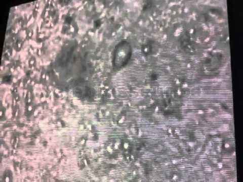 Video giardiose chien - Clinique vétérinaire Brasseur